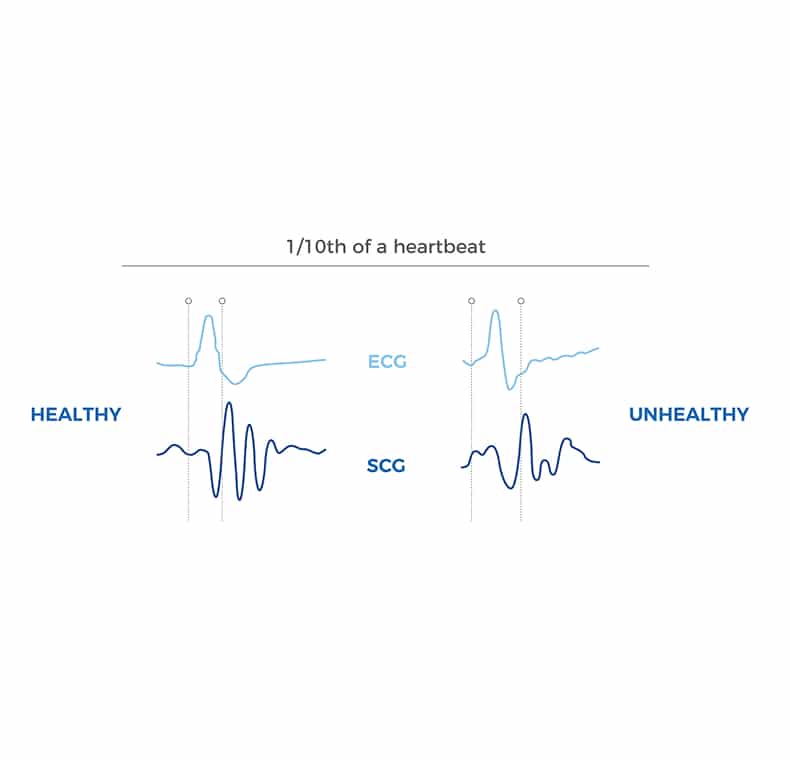 SCG’s high sensitivity to mechanical movements